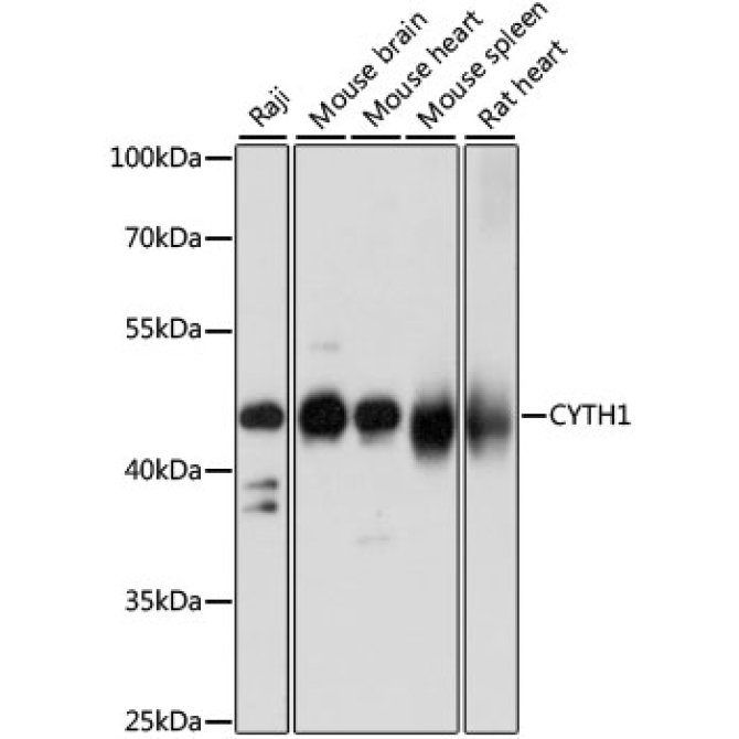 CYTH1 Rabbit Polyclonal Antibody