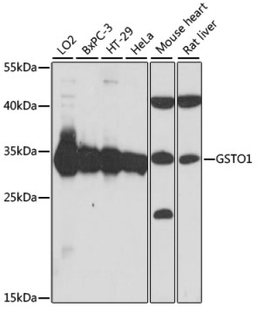 GSTO1 Rabbit Polyclonal Antibody