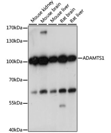 ADAMTS1 Rabbit Polyclonal Antibody