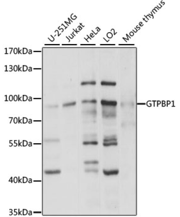 GTPBP1 Rabbit Polyclonal Antibody
