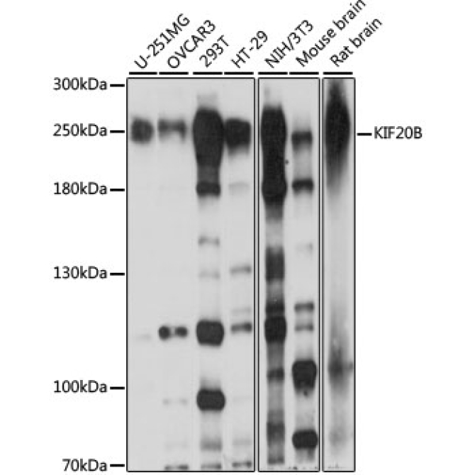 KIF20B Rabbit Polyclonal Antibody
