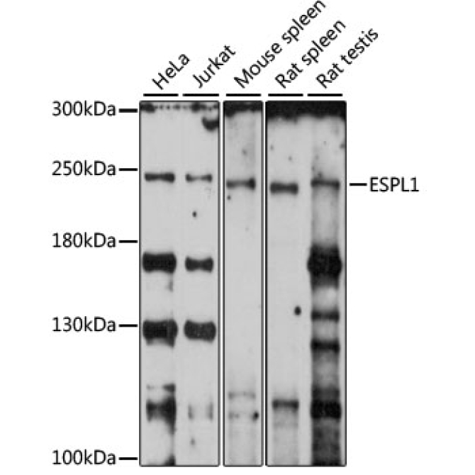 ESPL1 Rabbit Polyclonal Antibody
