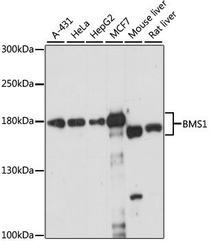 BMS1 Rabbit Polyclonal Antibody