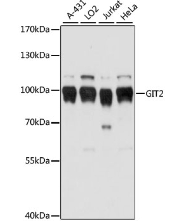 GIT2 Rabbit Polyclonal Antibody