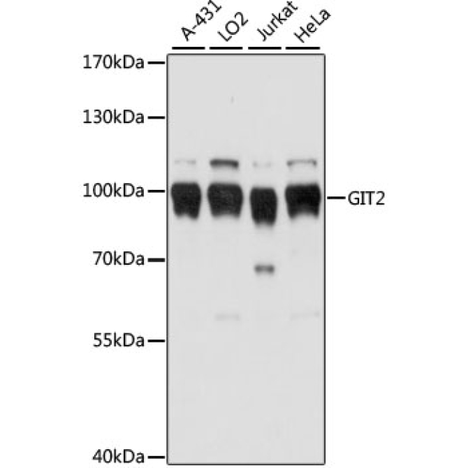 GIT2 Rabbit Polyclonal Antibody