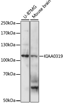 KIAA0319 Rabbit Polyclonal Antibody