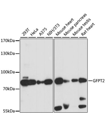 GFPT2 Rabbit Polyclonal Antibody