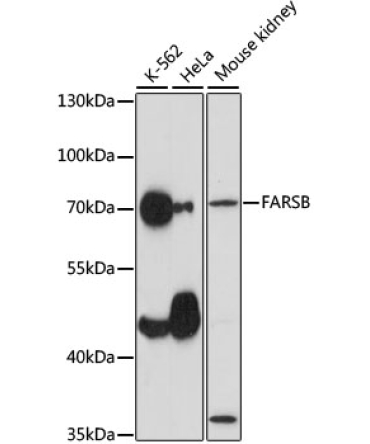 FARSB Rabbit Polyclonal Antibody