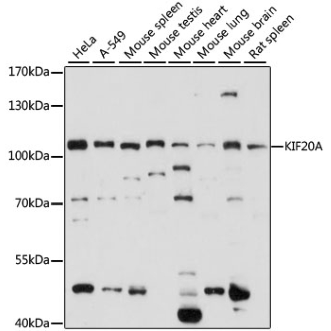 KIF20A Rabbit Polyclonal Antibody