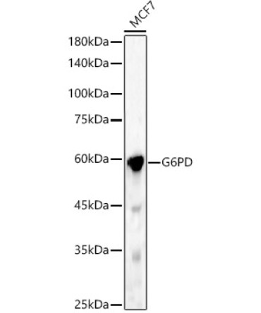 G6PD Rabbit Polyclonal Antibody