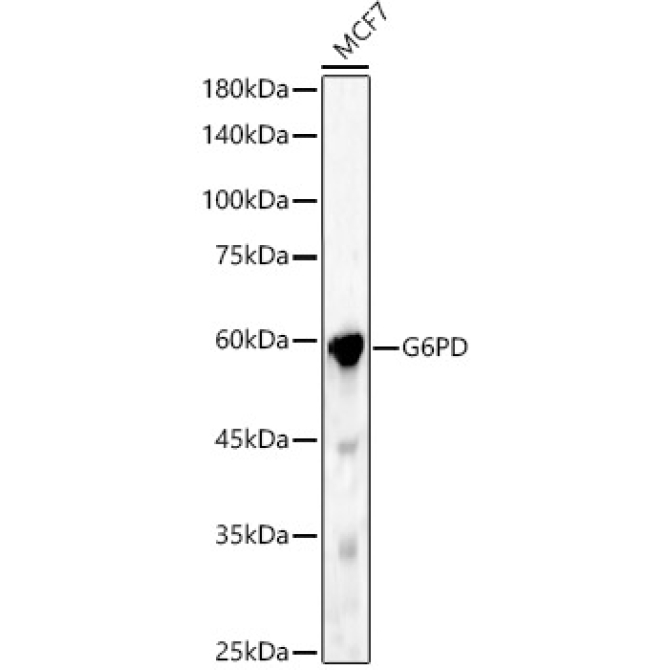 G6PD Rabbit Polyclonal Antibody