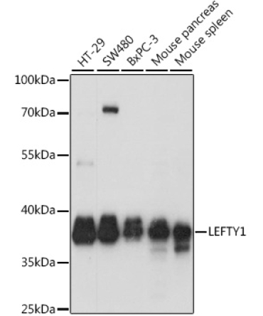 LEFTY1 Rabbit Polyclonal Antibody