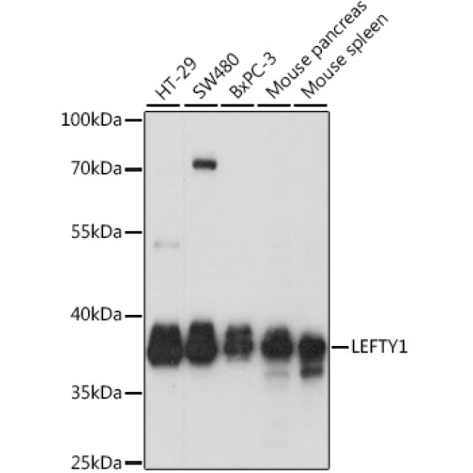 LEFTY1 Rabbit Polyclonal Antibody