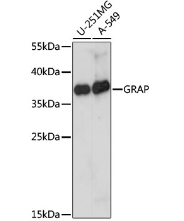 GRAP Rabbit Polyclonal Antibody