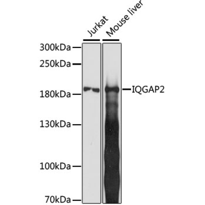 IQGAP2 Rabbit Polyclonal Antibody