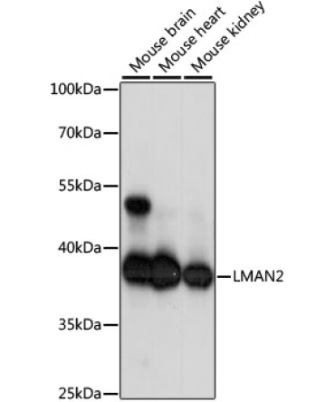 LMAN2 Rabbit Polyclonal Antibody