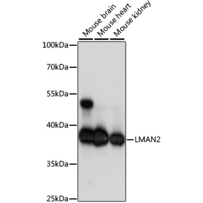 LMAN2 Rabbit Polyclonal Antibody