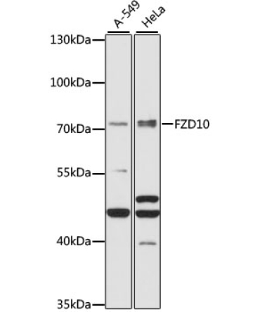 FZD10 Rabbit Polyclonal Antibody