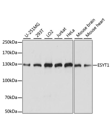ESYT1 Rabbit Polyclonal Antibody