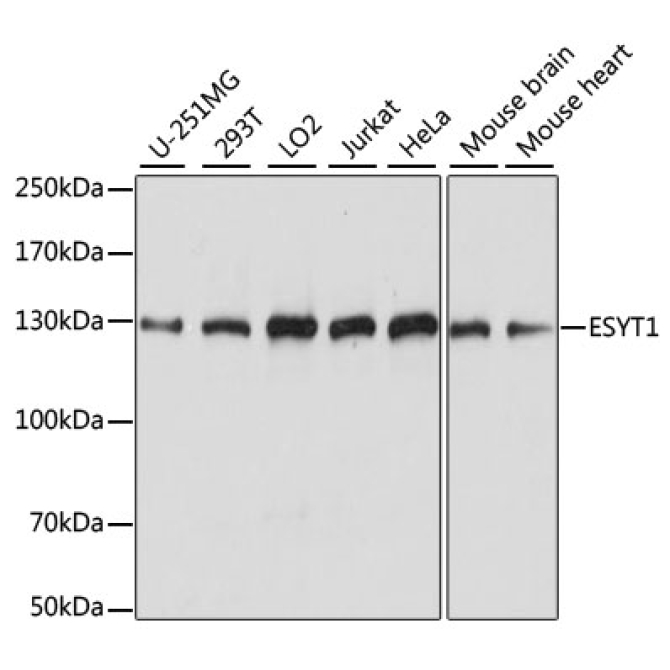 ESYT1 Rabbit Polyclonal Antibody