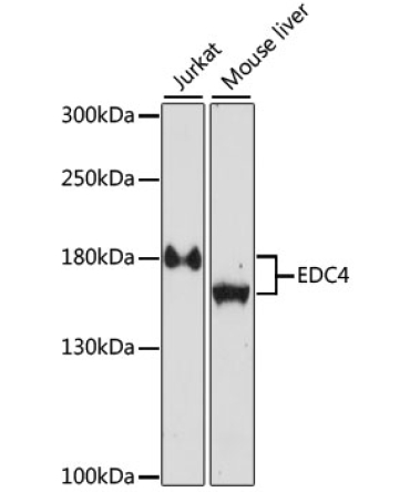 EDC4 Rabbit Polyclonal Antibody