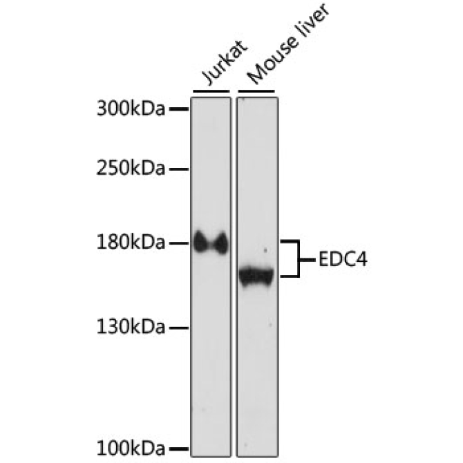 EDC4 Rabbit Polyclonal Antibody