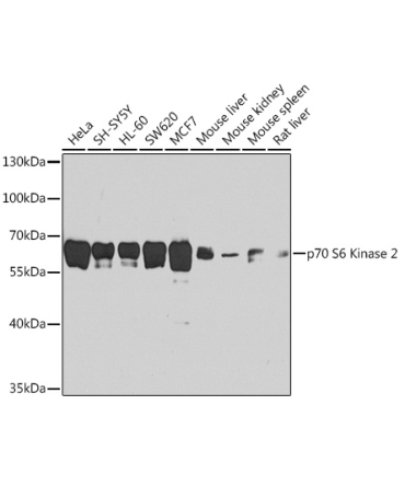 p70 S6 Kinase 2 Rabbit Polyclonal Antibody