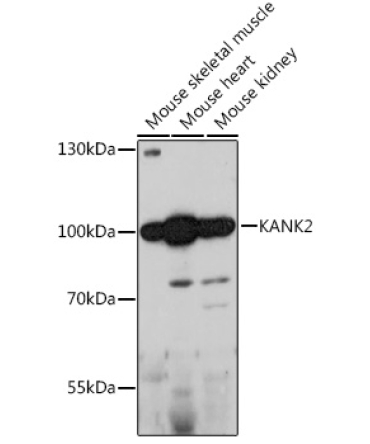 KANK2 Rabbit Polyclonal Antibody