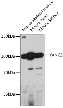 KANK2 Rabbit Polyclonal Antibody