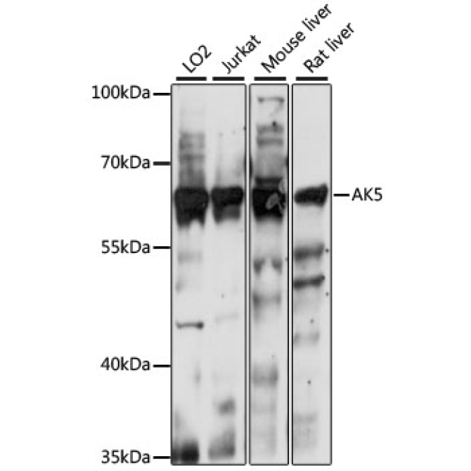 AK5 Rabbit Polyclonal Antibody