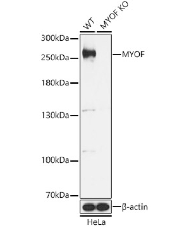 MYOF Rabbit Polyclonal Antibody [KO Validated]