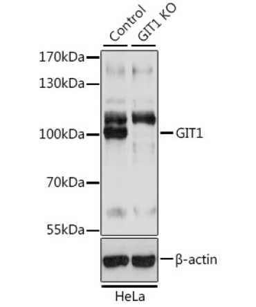 GIT1 Rabbit Polyclonal Antibody [KO Validated]