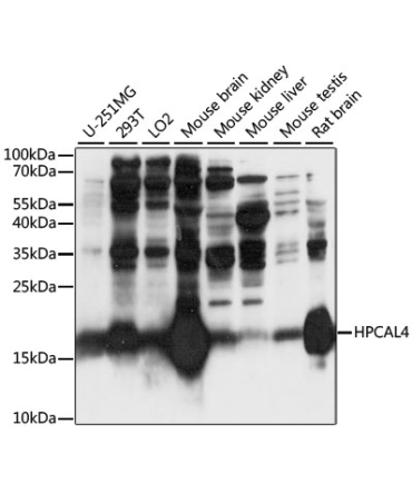HPCAL4 Rabbit Polyclonal Antibody
