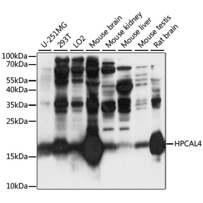 HPCAL4 Rabbit Polyclonal Antibody