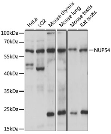NUP54 Rabbit Polyclonal Antibody