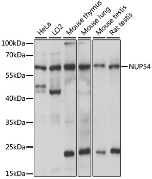 NUP54 Rabbit Polyclonal Antibody