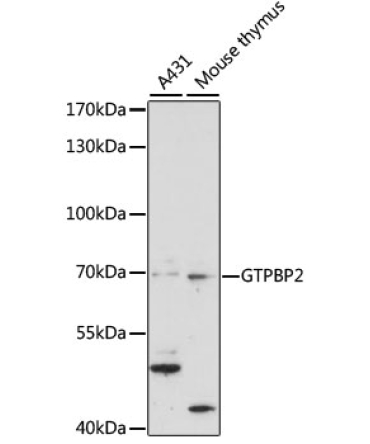 GTPBP2 Rabbit Polyclonal Antibody