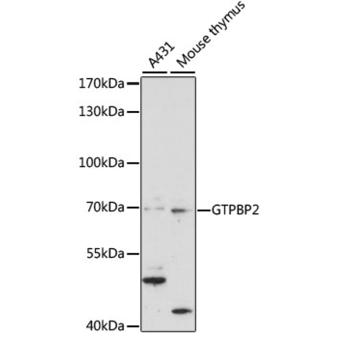 GTPBP2 Rabbit Polyclonal Antibody