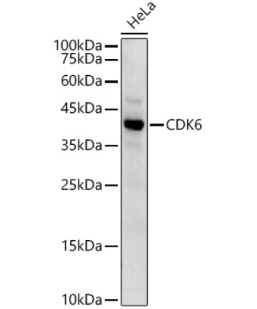 CDK6 Rabbit Polyclonal Antibody