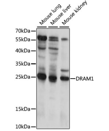DRAM1 Rabbit Polyclonal Antibody