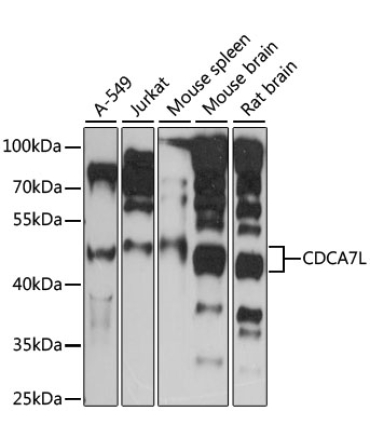 CDCA7L Rabbit Polyclonal Antibody