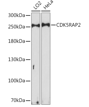 CDK5RAP2 Rabbit Polyclonal Antibody
