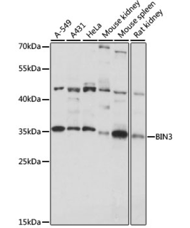 BIN3 Rabbit Polyclonal Antibody