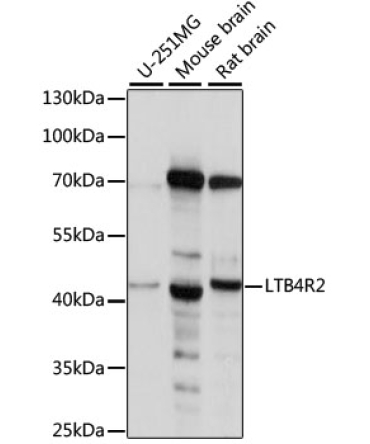 LTB4R2 Rabbit Polyclonal Antibody