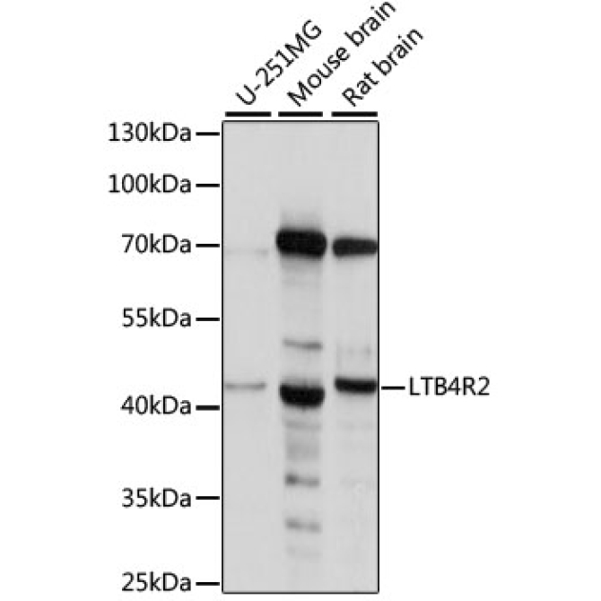 LTB4R2 Rabbit Polyclonal Antibody