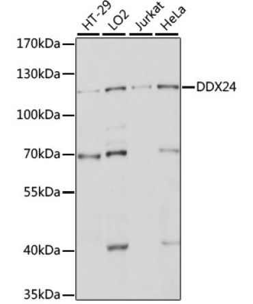 DDX24 Rabbit Polyclonal Antibody