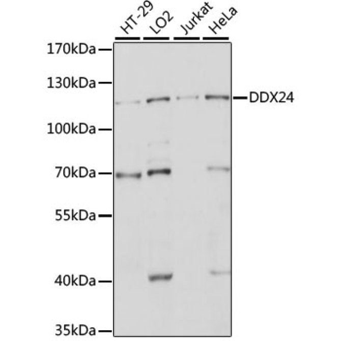 DDX24 Rabbit Polyclonal Antibody