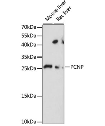 PCNP Rabbit Polyclonal Antibody