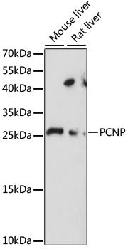PCNP Rabbit Polyclonal Antibody