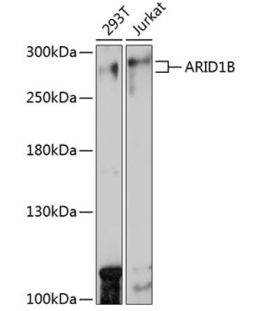 ARID1B Rabbit Polyclonal Antibody